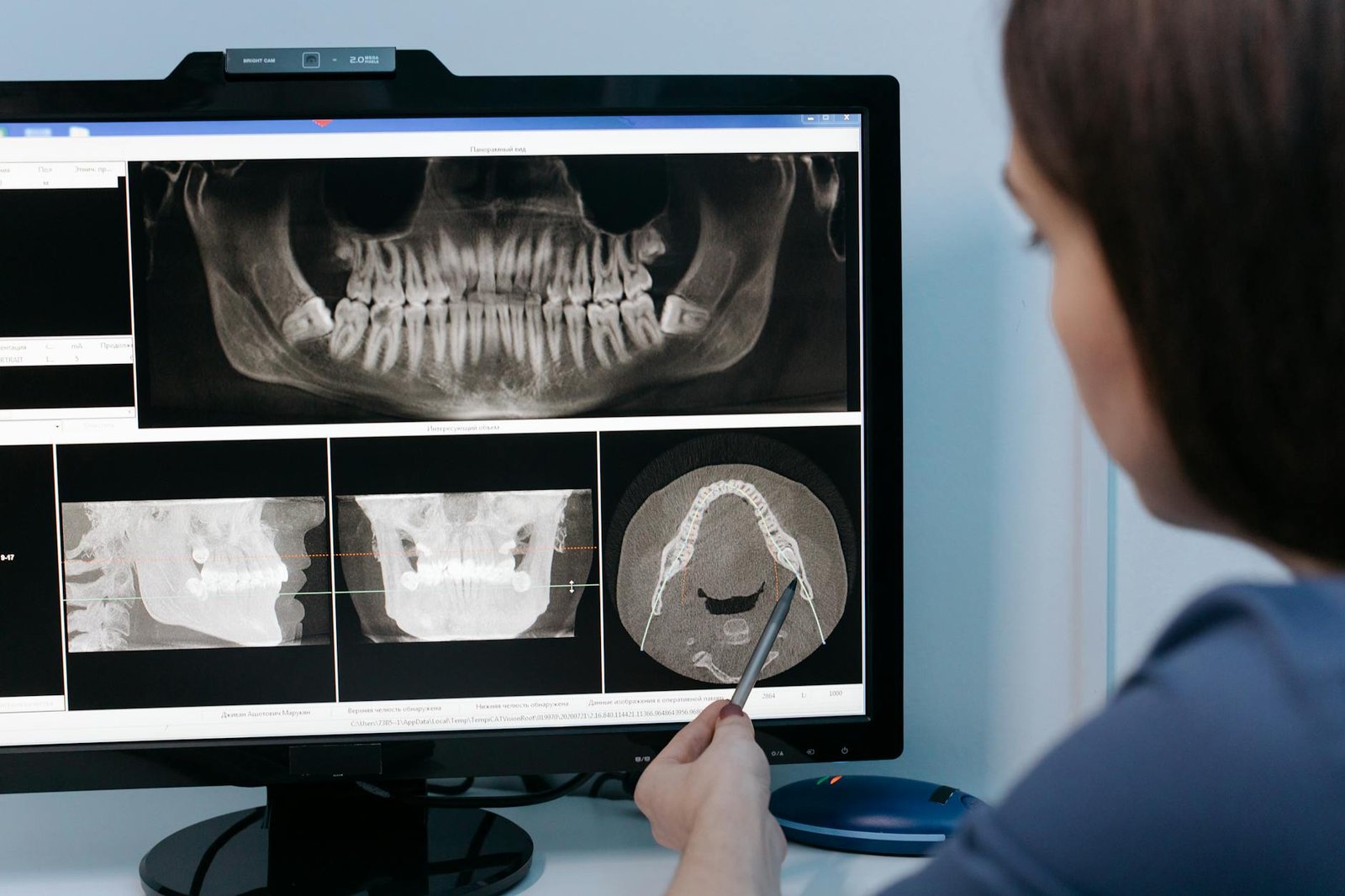 Understanding CBCT Technology and Its Core Advantages
