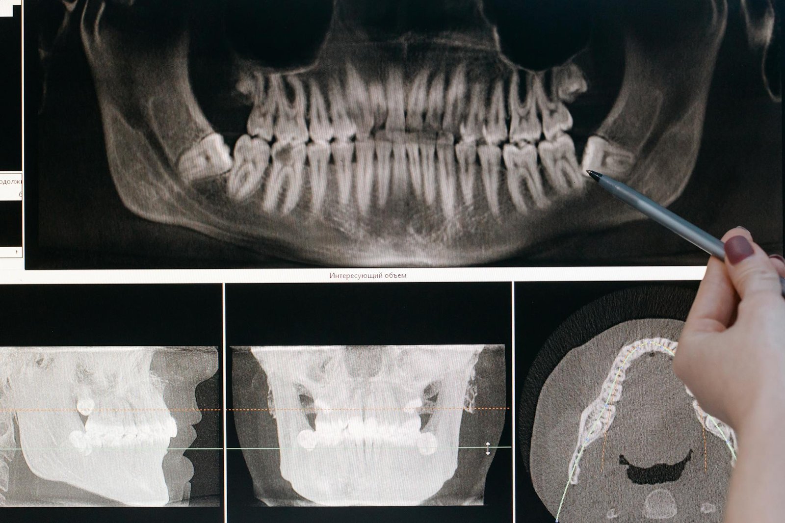 Conventional Radiographs: Proven Benefits and Applications