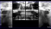 2D TMJ VIEW REPORTING