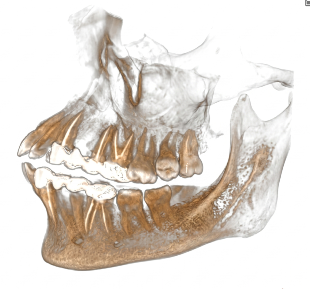 Endodontic Assessment