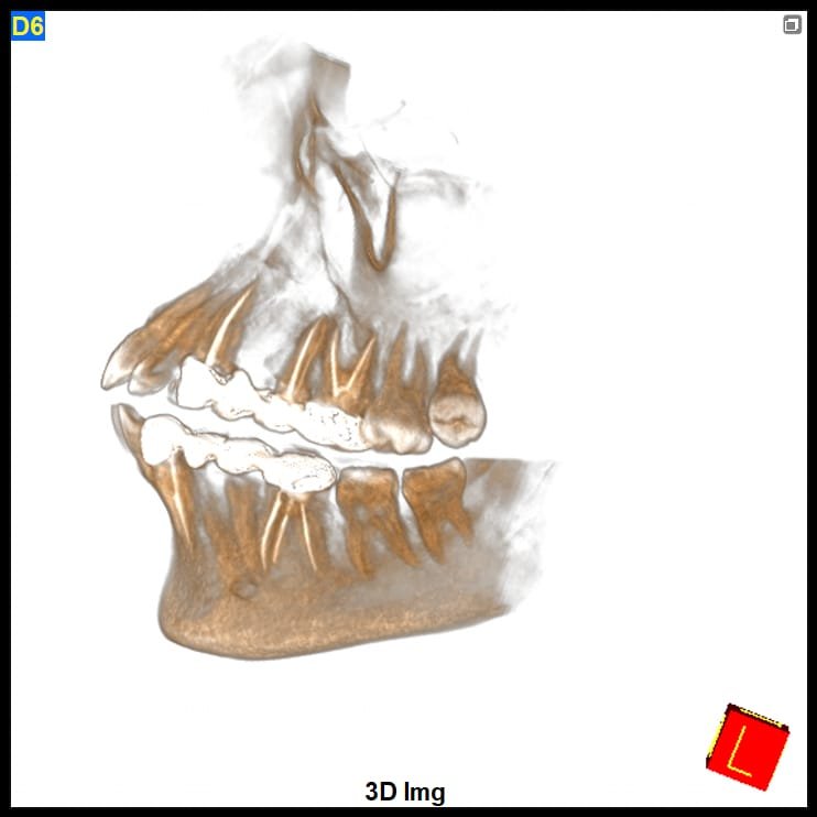 Endodontic Assessment